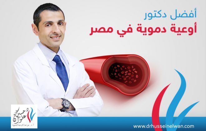 افضل دكتور اوعية دموية في مصر | دكتور اوعية دموية شاطر 4 افضل دكتور اوعية دموية في مصر