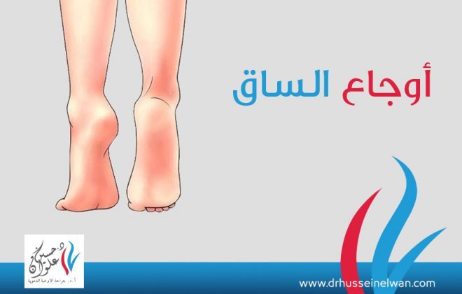 أوجاع الساق 4 اسباب أوجاع الساق