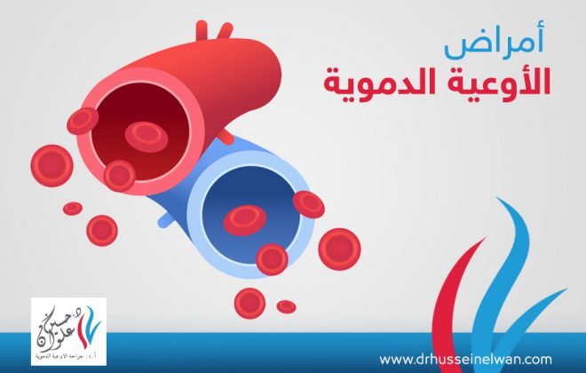 ما هي المشاكل التي تتطلب زيارة عيادة اوعية دموية؟ 3 عيادة اوعية دموية