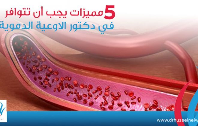 5 مميزات يجب أن تتوافر في دكتور الاوعية الدموية في مصر 4 5 مميزات يجب أن تتوافر في دكتور الاوعية الدموية2