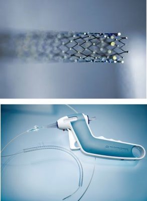 استخدام الدعامات الطرفيه في علاج ضيق شرايين الساق 8 Untitled 17