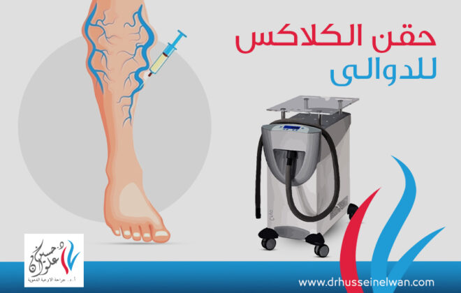 تعرف على تقنية الكلاكس : أحدث طرق علاج الشعيرات الدمويه 2 تقنية الكلاكس في علاج الدوالي