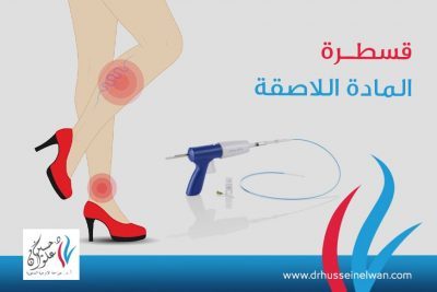 قسطرة-المادة-الااصقة (1) قسطرة المادة اللاصقة