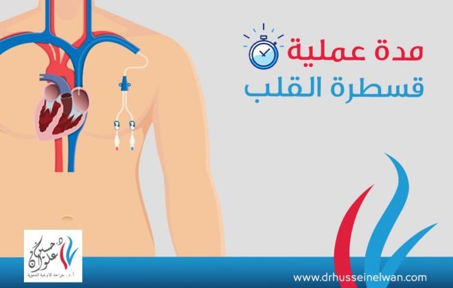 كل ما تريد معرفته عن عملية القسطرة القلبية 2 كل ما تريد معرفته عن عملية القسطرة القلبية