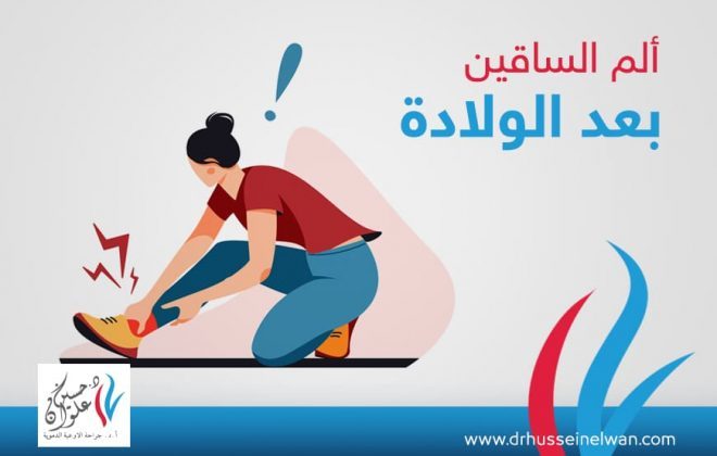 ألم الساقين بعد الولادة 3 ألم الساق بعد الولادة