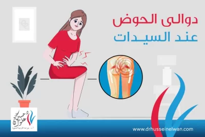 دوالي-الحوض-في-السيدات ما هي دوالي الحوض | أعراض وأسباب وعلاج