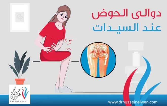 ما هي دوالي الحوض | أعراض وأسباب وعلاج 3 ما هي دوالي الحوض | أعراض وأسباب وعلاج
